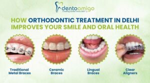 Orthodontic Treatment in Delhi – Traditional metal braces, ceramic braces, lingual braces, and clear aligners offered at Dentoamigo dental clinic.