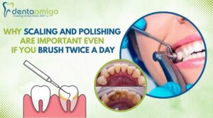A dental professional performing scaling and polishing in Delhi, showing plaque removal tools, clean teeth, and before-and-after results of dental cleaning.
