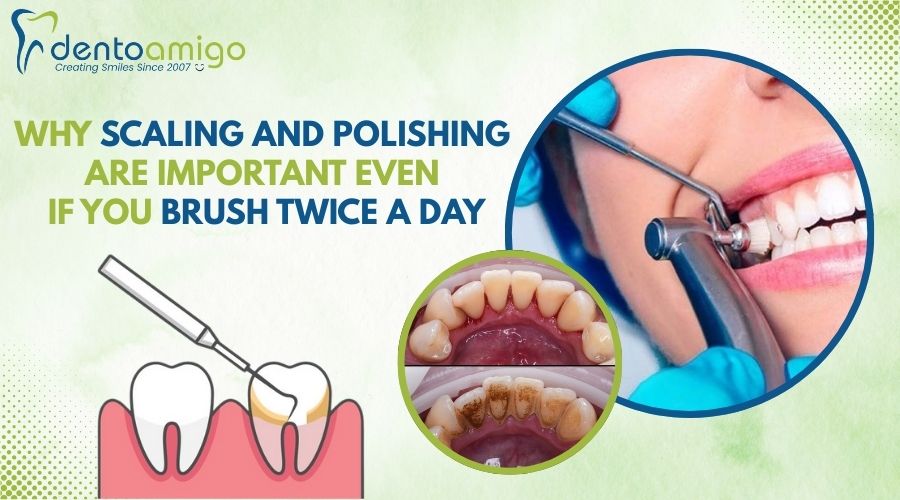 Why Scaling and Polishing Are Important Even If You Brush Twice a Day