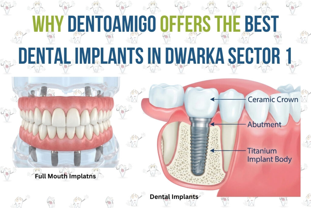 Why Dentoamigo Offers the Best Dental Implants in Dwarka Sector 1
