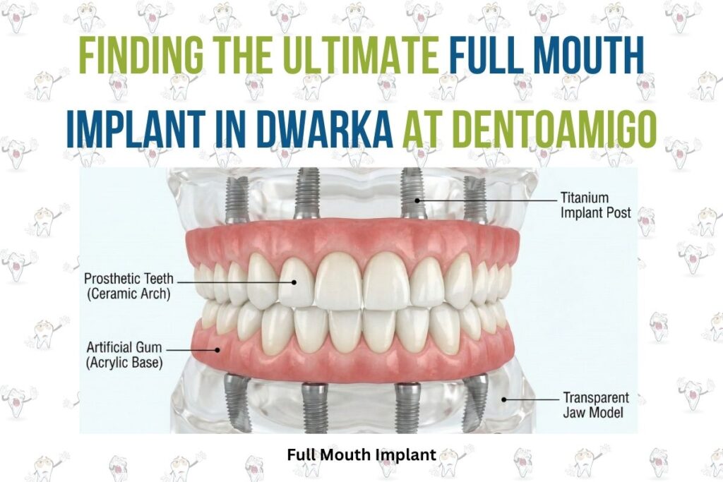 Finding the Ultimate Full Mouth Implant in Dwarka at Dentoamigo