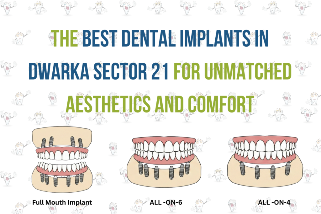 The Best Dental Implants in Dwarka Sector 21 for Unmatched Aesthetics and Comfort