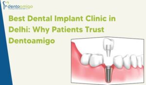 best dental implant clinic in delhi